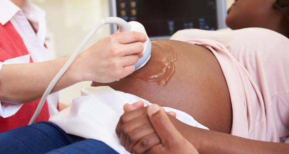 A Black pregnant woman having a sonography scan